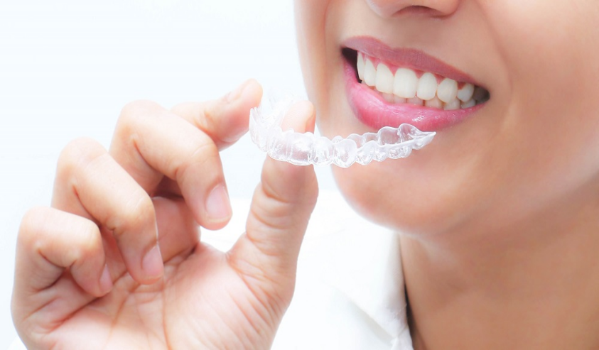 Clear Aligners 